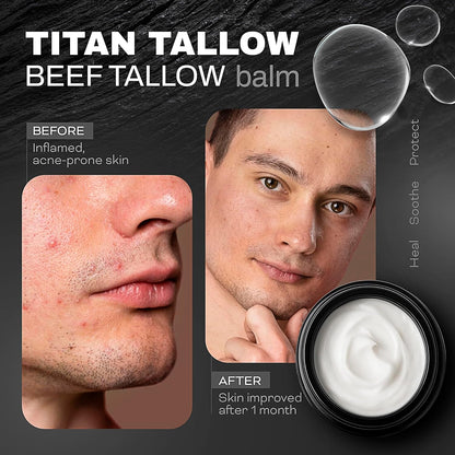 Beef Tallow for Skin, Face & Body Balm with Magnesium for Sleep, Leg Cramps & Pain, Muscle Relaxation, Moisturizing Topical Cream - Organic Grass-Fed & Grass-Finished Tallow, Manuka Honey Lotion